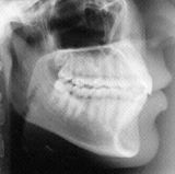 Radiologia Odontológica em Joinville